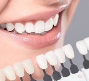 عوارض لمینت دندان ، عوارض کامپوزیت دندان