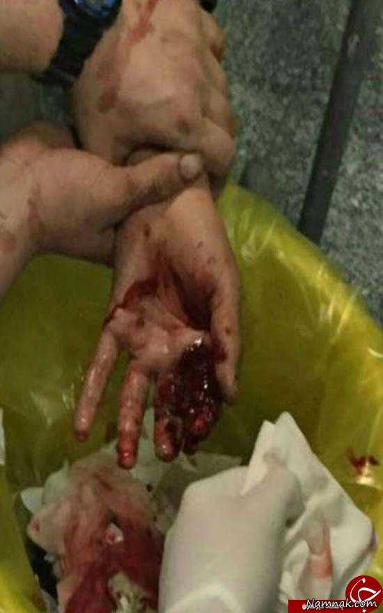 حوادث چهارشنبه سوری ، کشته های چهارشنبه سوری ، چهارشنبه سوری