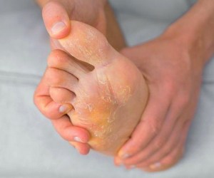 درمان پای ورزشکار