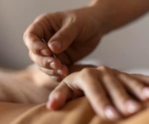 لاغری با طب سوزنی