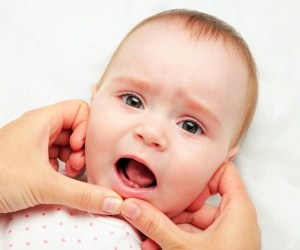 پوسیدگی دندان کودک شیرخوار