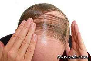 علت ریزش مو و درمان آن 1