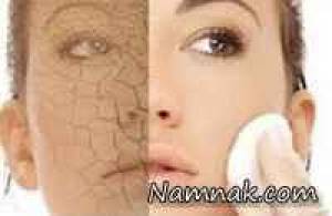 پوست خشک ، آرایش