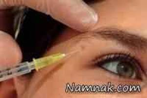 بوتاکس ، انواع بوتاکس