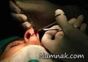 بیشترین ، جراحی