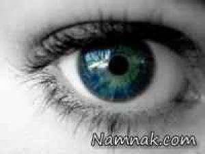 راه در مان فشار چشم ، خلاصی از سوزش چشم