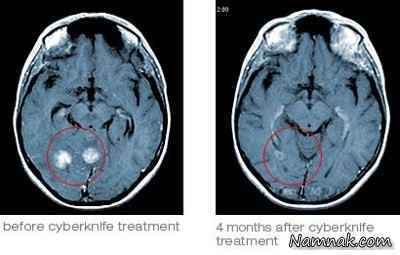 ام-آر-آی-(MRI)-و-کاربردهای-آن-+-عکس