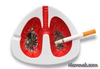 سیگار کشیدن از علل آبسه ریه ، آبسه ریه ، ‌ سلامت