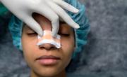 جراحی بینی و سینه محبوبترین عمل های زیبایی