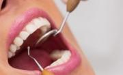 معاینه دندان