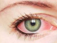 علت و درمان عفونت چشم