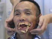 مردی با فک گرگ خورده