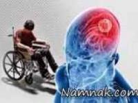 بیماری-ام-اس