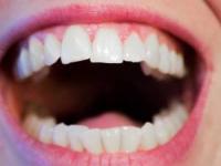 تغذیه لثه