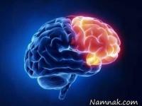 آتروفی مخچه