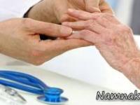 آرتروز روماتوئید