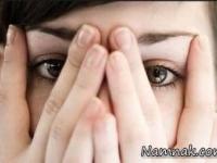 زشت بودن