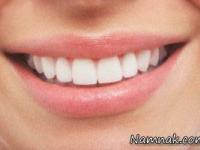 پوسیدگی دندان ها