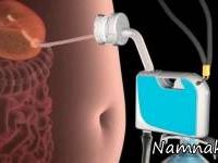 دستگاه لاغری