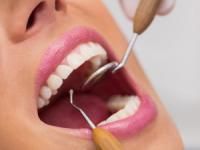 انواع دندانپزشک