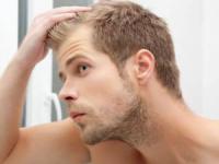 دلیل ریزش مو و درمان آن