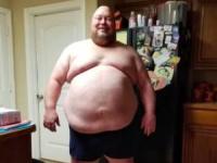 کاهش وزن باورنکردنی یک مرد 