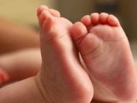 کج شدن پای نوزاد