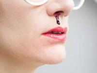 بیماری هموفیلی