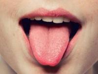 سکته حس چشایی 