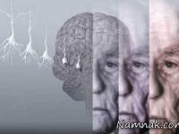 درمان آلزایمر