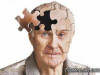 مقابله با آلزایمر