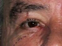 فرو رفتن ماهیتابه