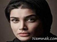 مصدومیت تینا آخوند تبار