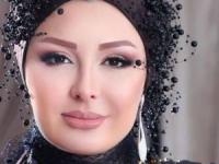 بازیگران قبل و بعد از عمل
