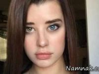 چشمان دورنگ