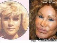 جراحی زیبایی