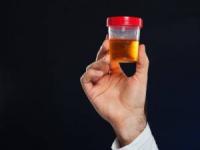 ادرار افراد سالم 