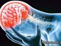 داروی رماتیسم