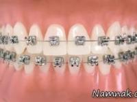 ارتودنسی دندان