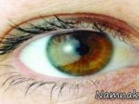 سلامت چشم