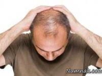 آب آهن دار مانع ریزش مو