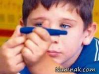 پیوند لوزالمعده مصنوعی