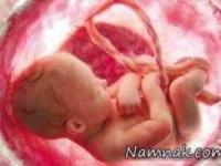 مصرف الکل در بارداری