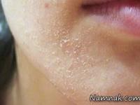 درخواست های بدن