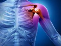 دررفتگی کتف