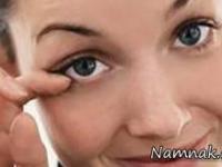 تیک های عصبی