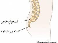 درد دنبالچه بعد از زایمان