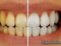 سفید کننده دندان