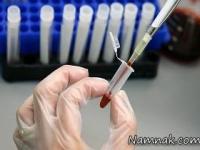 ویروس اچ آی وی