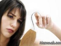 ریزش مو